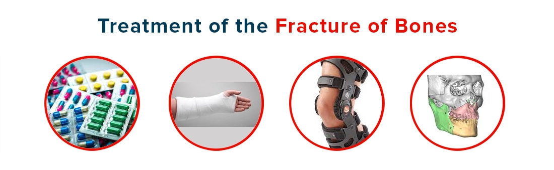 Treatment of the Fracture of Bones